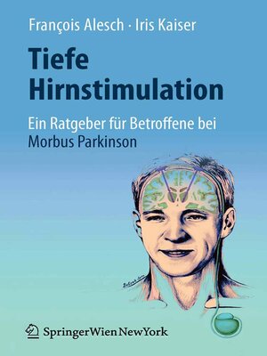 cover image of Tiefe Hirnstimulation